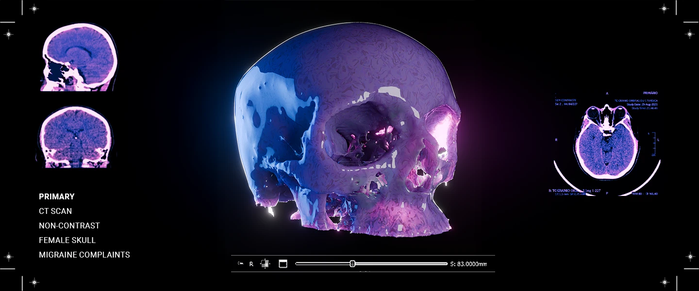 Crânio 3D com material translúcido azul e violeta